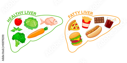 Healthy and unhealthy food in shape of human liver. Fatty liver awareness concept.  Vector illustration.