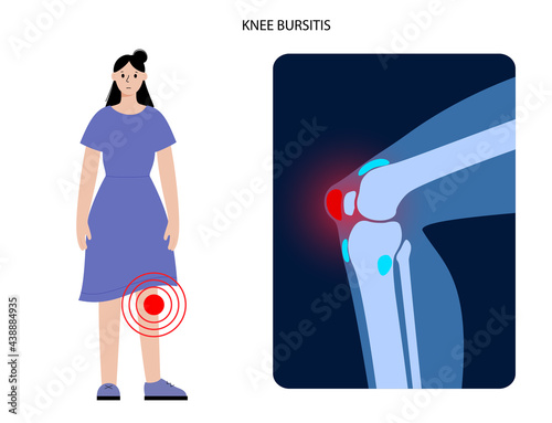 Bursitis inflammation concept
