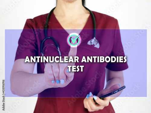  ANTINUCLEAR ANTIBODIES TEST ANA phrase on the screen. Doctor use cell technologies at office. photo