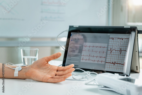 Foto Biofeedback - Female hand with attached sensors for heart rate measurement