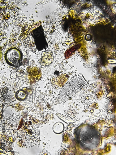 Vászonkép Transmitted light microscopy of house dust sample