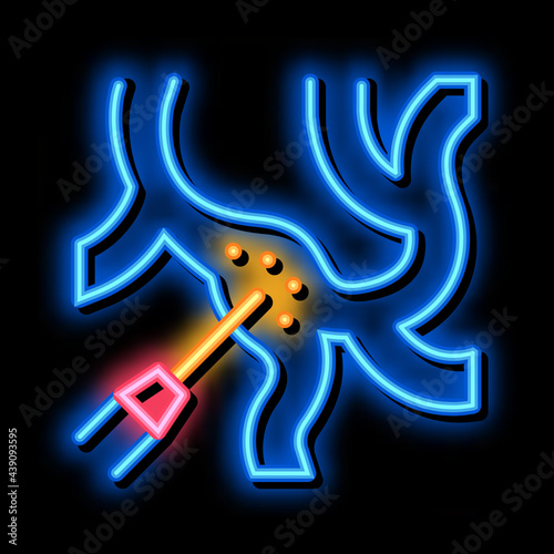 laser treatment varicose veins neon light sign vector. Glowing bright icon laser treatment varicose veins sign. transparent symbol illustration