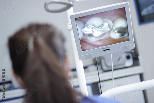 mujer viendo en monitor amalgama dental photo