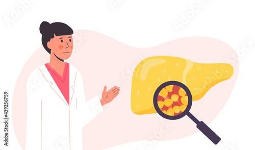 Unhealthy fatty liver. Damaged human organ under magnifying glass. Concept of Medical researcher or doctor studying fat liver tissue. Vector illustration in flat cartoon style isolated on white.