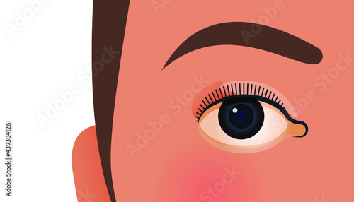 Ophthalmology. Modern Flat Vector Illustration. Female's Eye. Social Media Template.