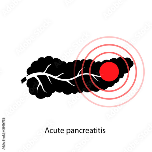 Pancreas disease and cancer