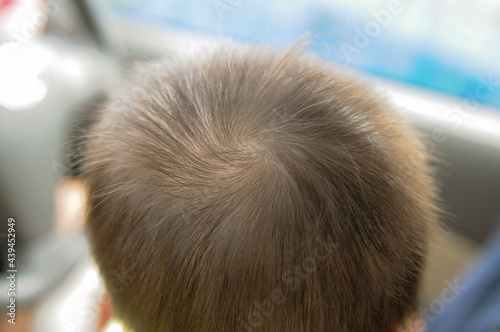 baby's hair whorl