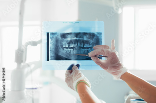 A Medical Worker Looking at X-Ray Image 