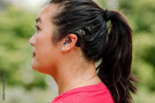 Profile of Asian woman with cochlear implant photo