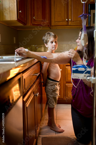 Boy with gastric port waits patiently as mother prepares feeding lines