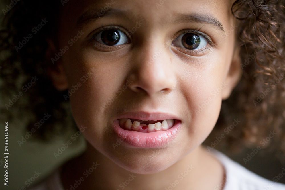 Anxious girl shows mouth with missing tooth
Anxious girl shows mouth with missing tooth