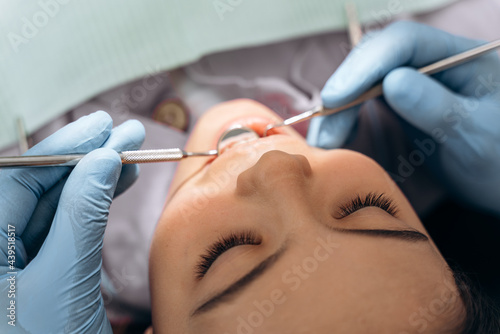Top view. The doctor treats the teeth of a young girl. Girl in the dental office