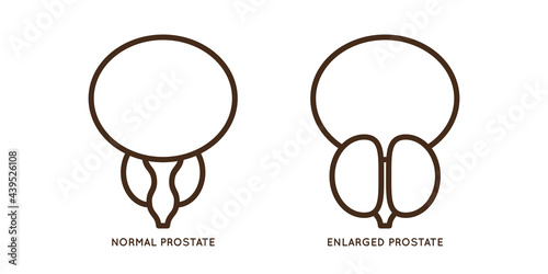 Male prostate disease vector icon flat illustration
