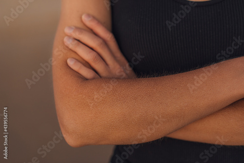 Goose flesh on female arms  photo