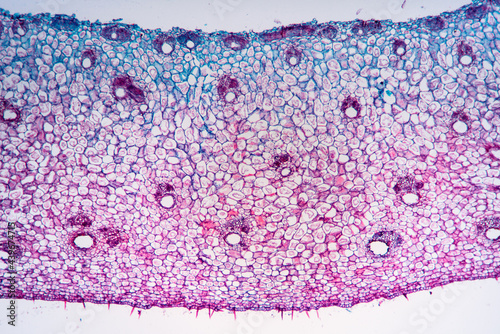 gallnut plant cells micrograph