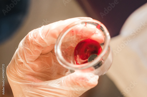 Vacuum cup filled with thickened blood photo
