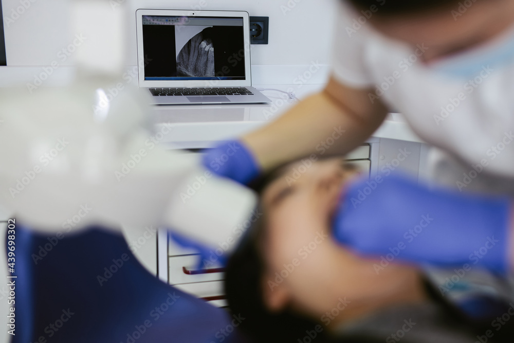 Results of CT scan transmitting on laptop Results of CT scan transmitting on laptop