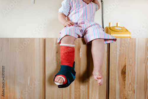 Close up of a toddler with a cast