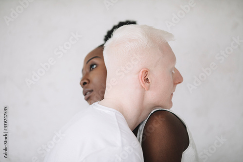 Portrait of a young black woman and male albino