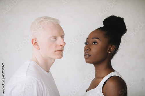 Portrait of a young black woman and male albino
