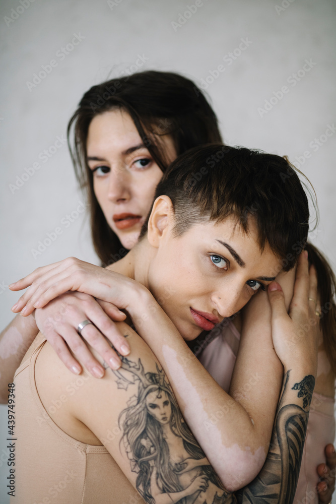 Portrait of a young tattooed woman and woman with vitiligo Portrait of a young tattooed woman and woman with vitiligo