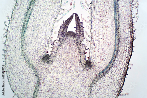 Shoot meristem is the tissue in most plants containing undifferentiated cells.
