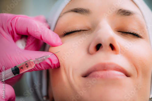 Canvas Print Dermal Filler Injection for Cheeks