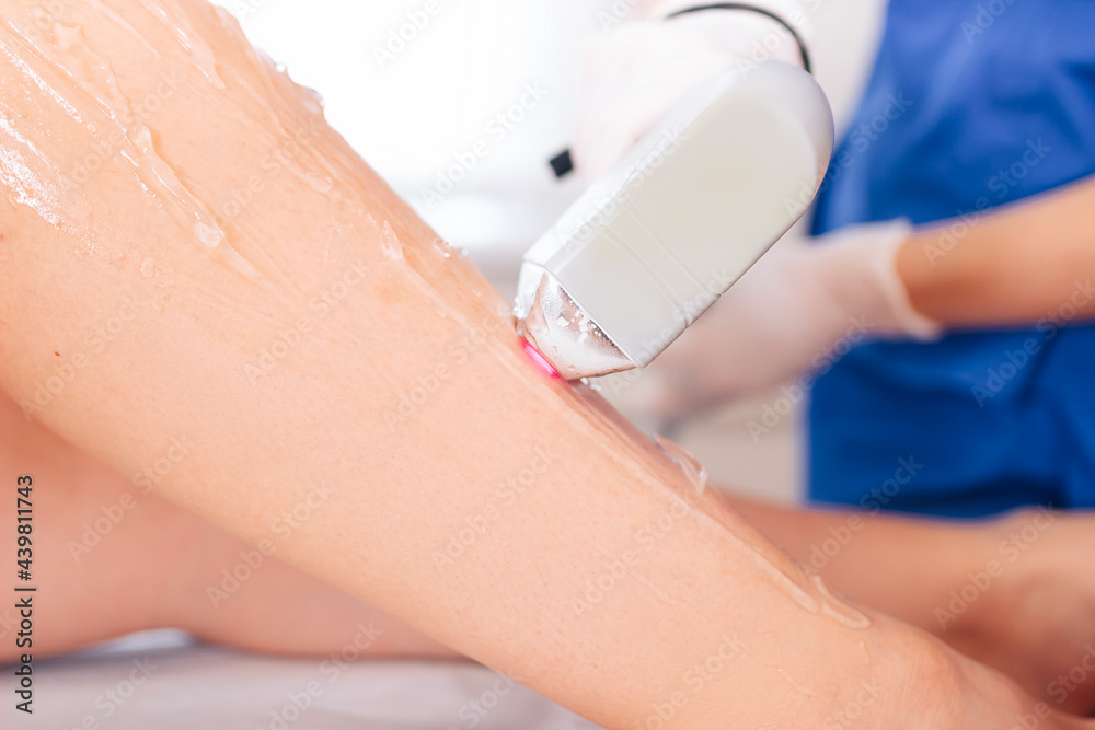 Naklejka premium Cosmetology procedure for hair removal from the master of laser hair removal in a cosmetic spa clinic. Laser hair removal and cosmetology.