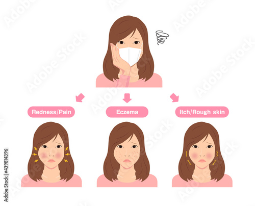 Vector illustration of skin troubles caused by wearing a mask.