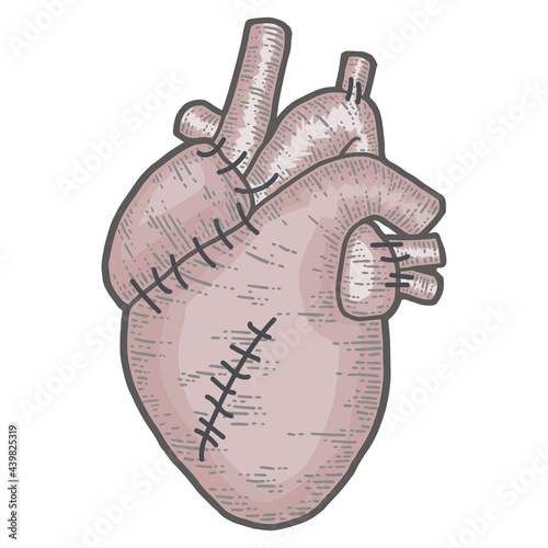 Human heart with stitches isolated on white background. Sketch scratch board imitation color.