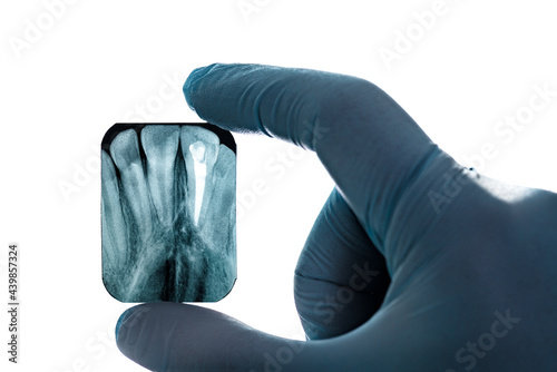 Radiography imaging upper canines root canal hand in glove isolated photo