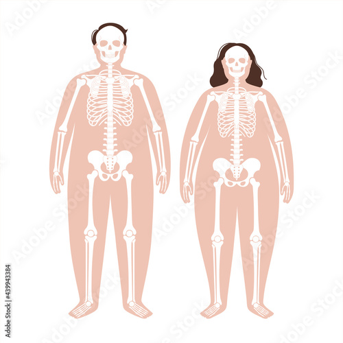 Obese skeleton anatomy