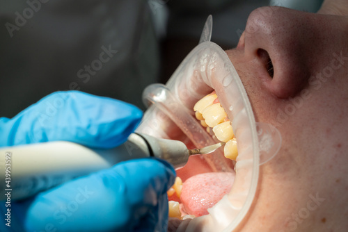 dentist make cleaning procedure for patient