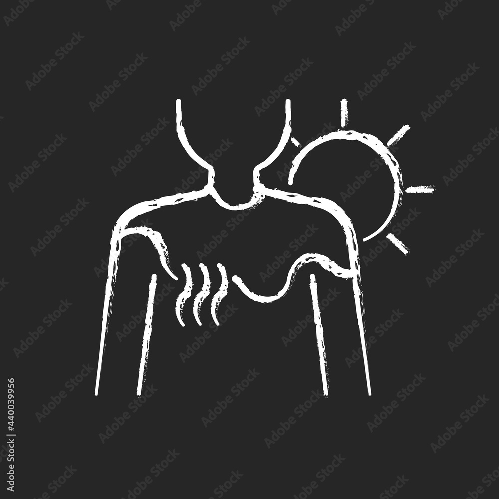 Sunburn chalk white icon on dark background. Person under sunlight exposure. Inflammation during summer from heatstroke. Irritation on skin. Isolated vector chalkboard illustration on black Sunburn chalk white icon on dark background. Person under sunlight exposure. Inflammation during summer from heatstroke. Irritation on skin. Isolated vector chalkboard illustration on black