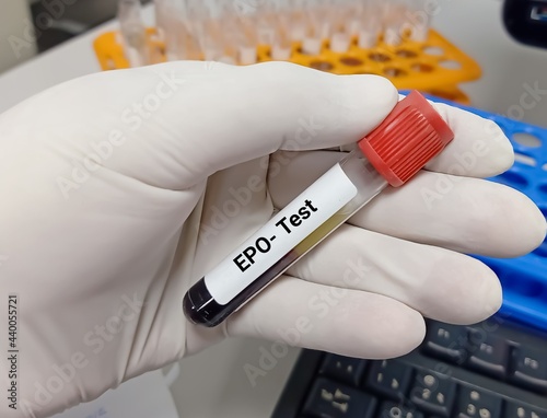 Biochemist or doctor holds blood sample for EPO (Erythropoietin) test, stimulating hormone for RBC production. Medical test tube in laboratory background. photo