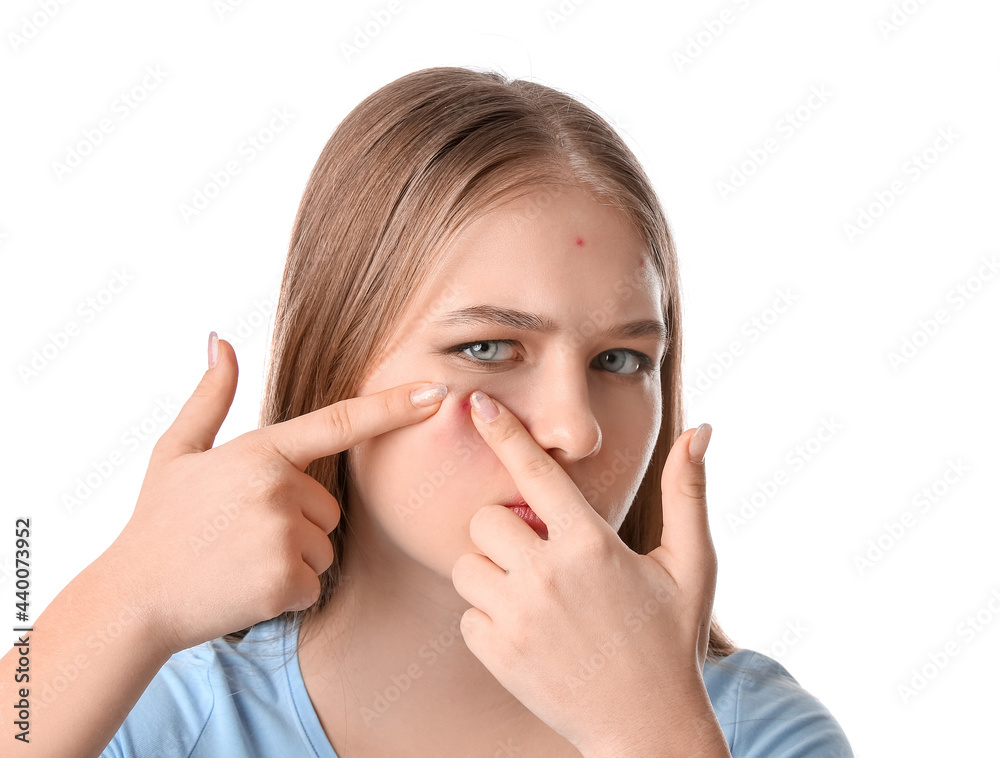 Teenage girl with acne problem on white background Teenage girl with acne problem on white background