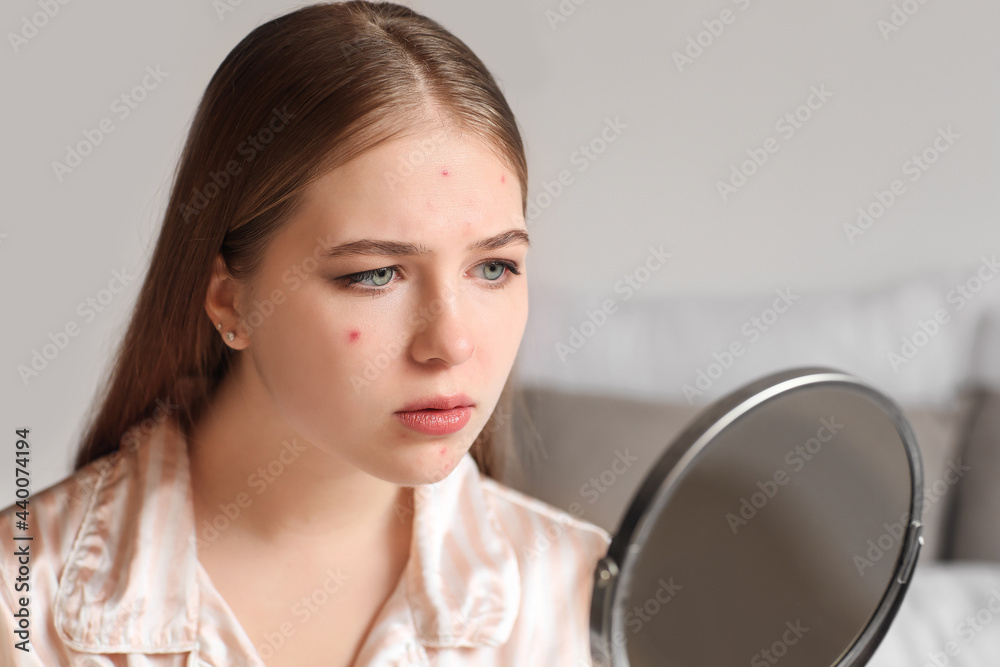 Teenage girl with acne problem looking in mirror at home Teenage girl with acne problem looking in mirror at home