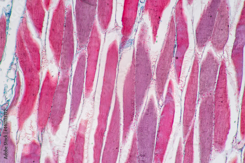 Characteristics of anatomy and Histological sample Striated (Skeletal) muscle of mammal Tissue under the microscope.
 photo