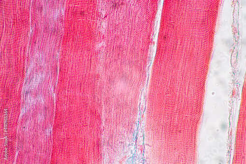 Characteristics of anatomy and Histological sample Striated (Skeletal) muscle of mammal Tissue under the microscope.
 photo