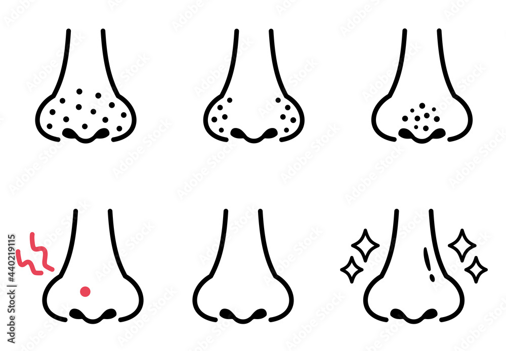 鼻の毛穴の汚れのイラスト　シンプル線画　Blackheads on the nose