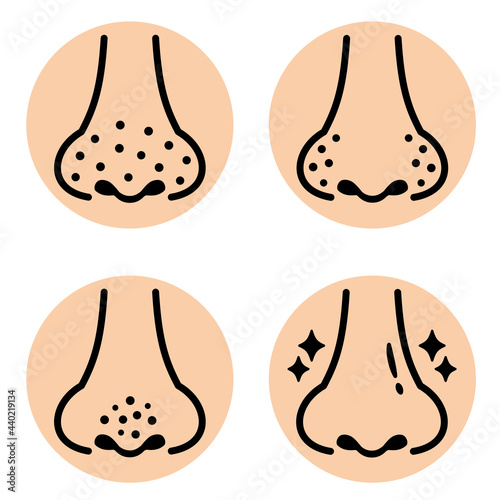 鼻の毛穴の汚れのイラストアイコン　シンプル線画　アイコン　nose blackhead pores