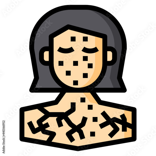 Cracked Skin