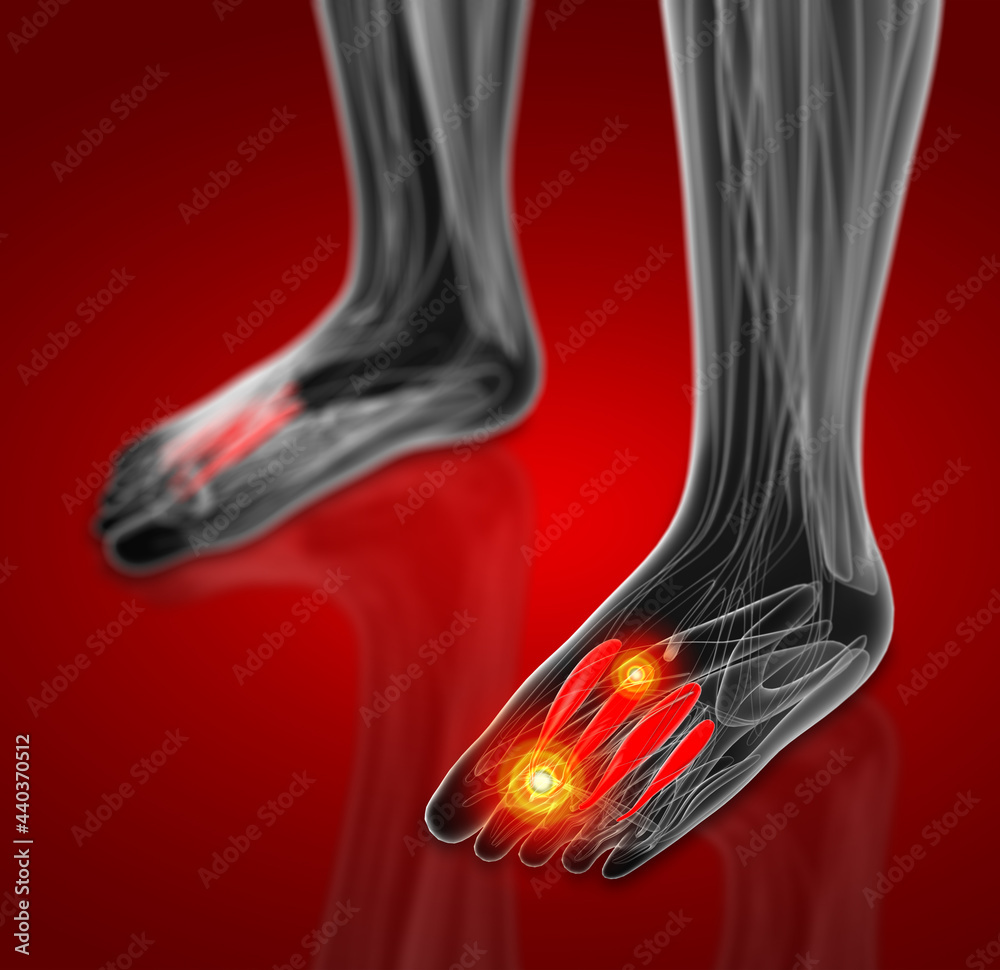 medical illustration of the Dorsal Plantar Interossei medical illustration of the Dorsal Plantar Interossei