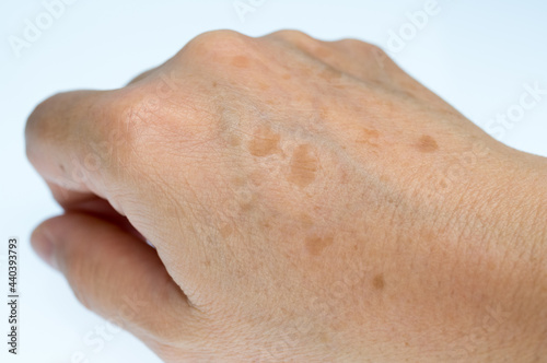 手の甲のシミに悩む女性の右手 photo