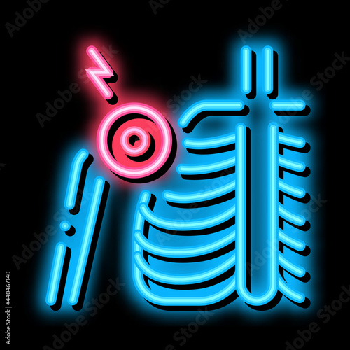 arthritis of shoulder joint neon light sign vector. Glowing bright icon arthritis of shoulder joint sign. transparent symbol illustration