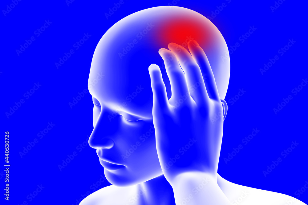 Obraz premium Headache 3D illustration
