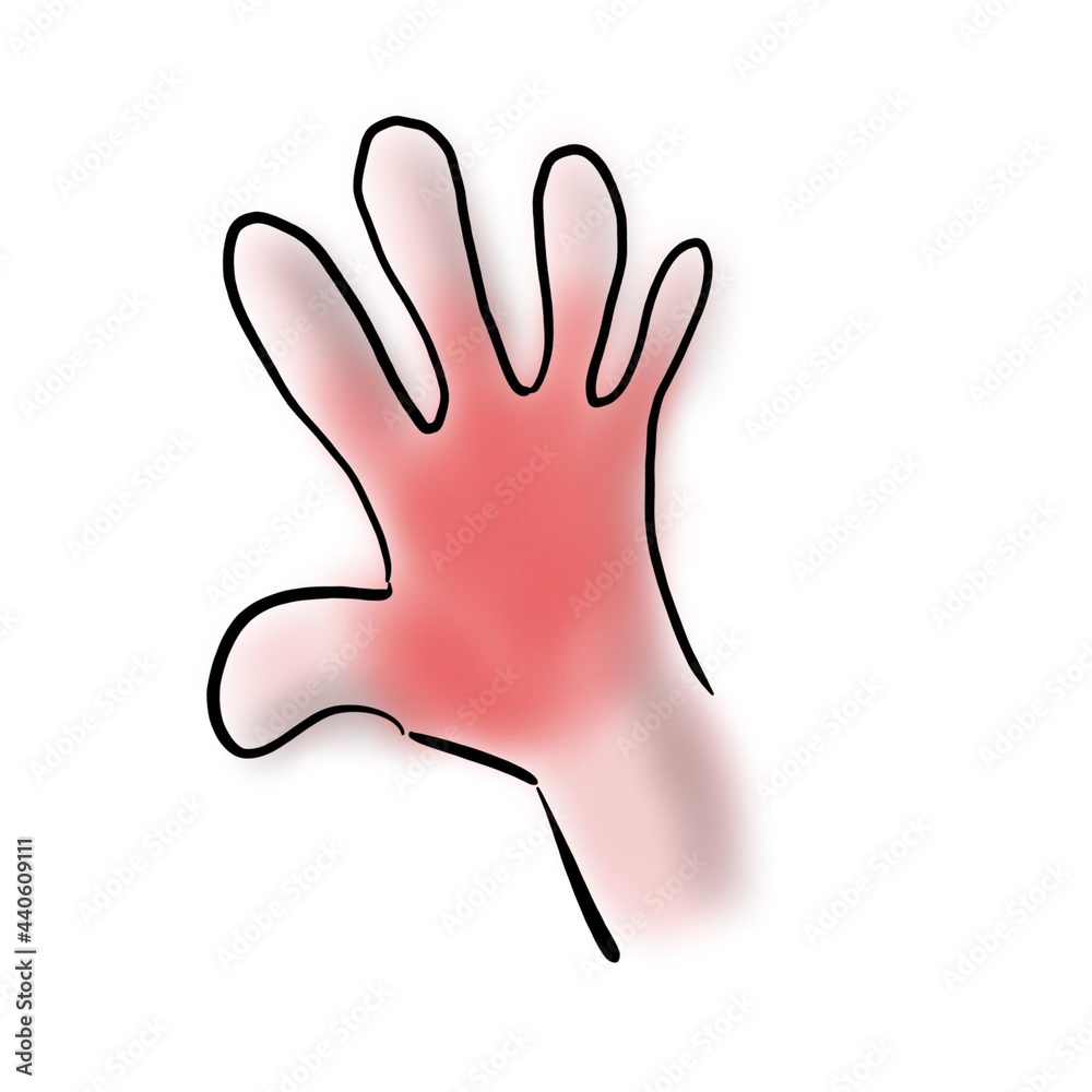 Obraz premium Inflammation on the human hand
