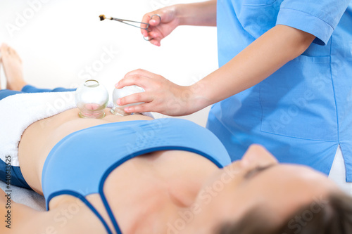 Vacuum cupping Therapy. Female physiotherapist applying glass suction banks on abdomen of her patient, during cupping therapy, closeup detail.