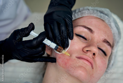 Konstfotografi cosmetologist stabs botox to patient