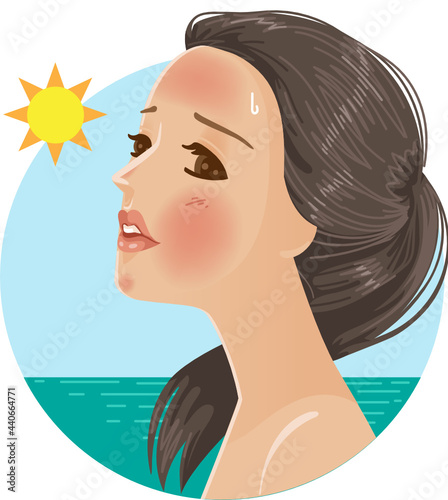 Women with a bad sunburn on her face skin